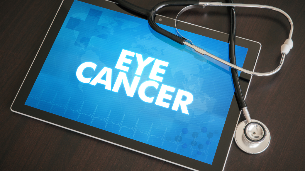Eye Cancer